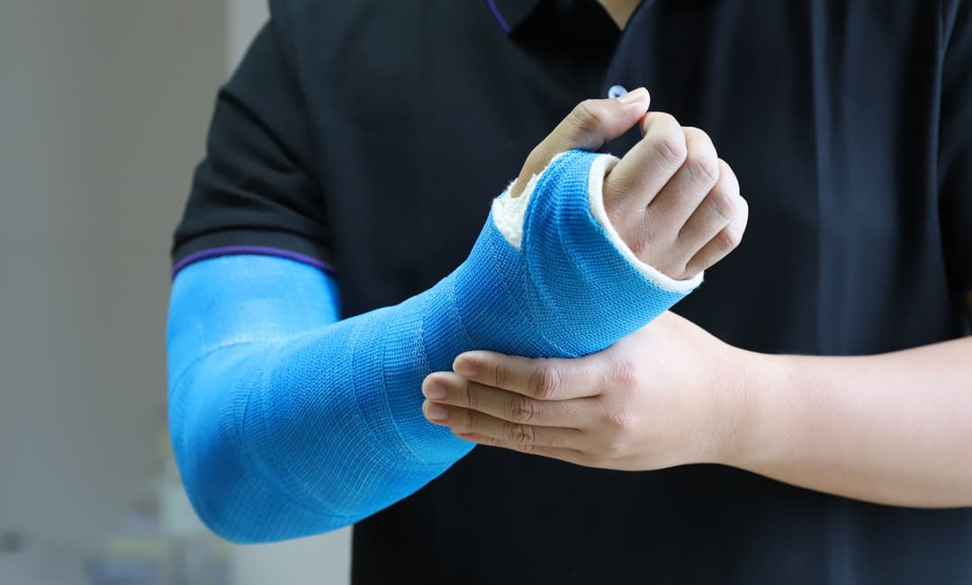 Personal Injury Cases Beyond Car Accidents in California